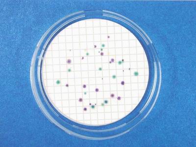 E.coli colonies(greenish blue colonies)