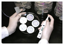Counting E. coli colonies on filter membrance